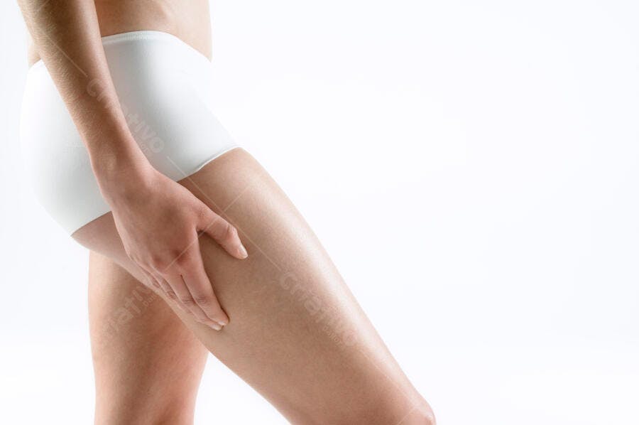 Perna feminina com celulite detalhe pele