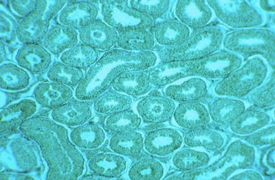 Microprismas (30)