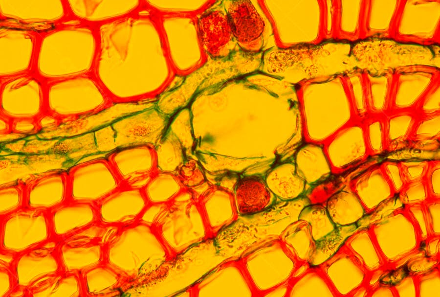 Microscopia vegetal células amarelas e vermelhas