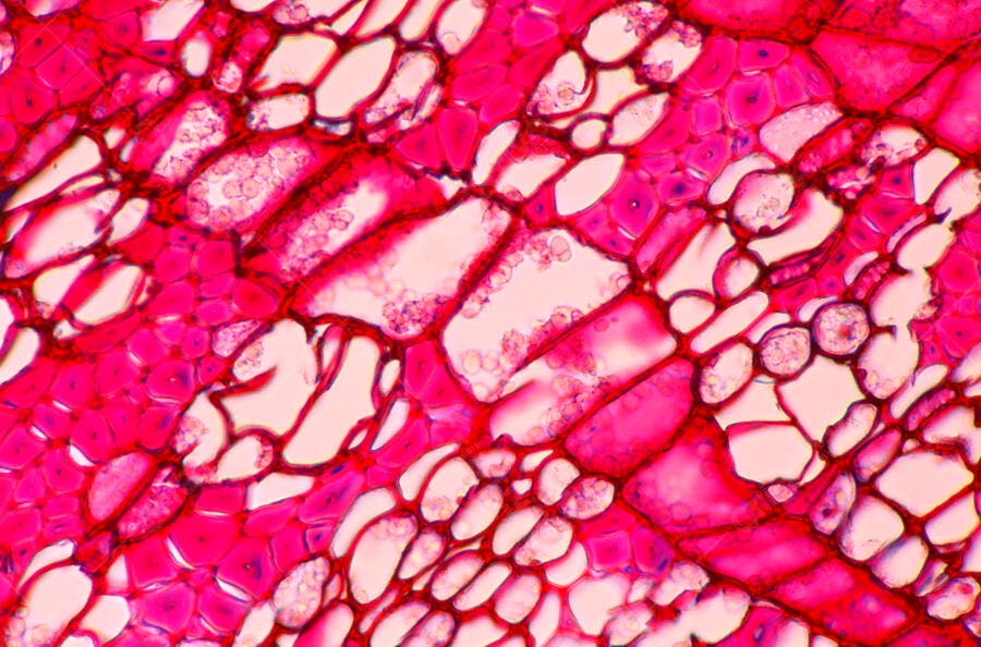 Microscopia de células vegetais rosa