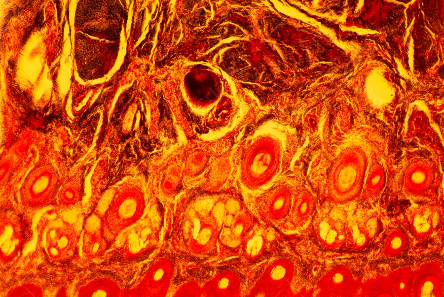 Microscopia tons laranja e vermelho