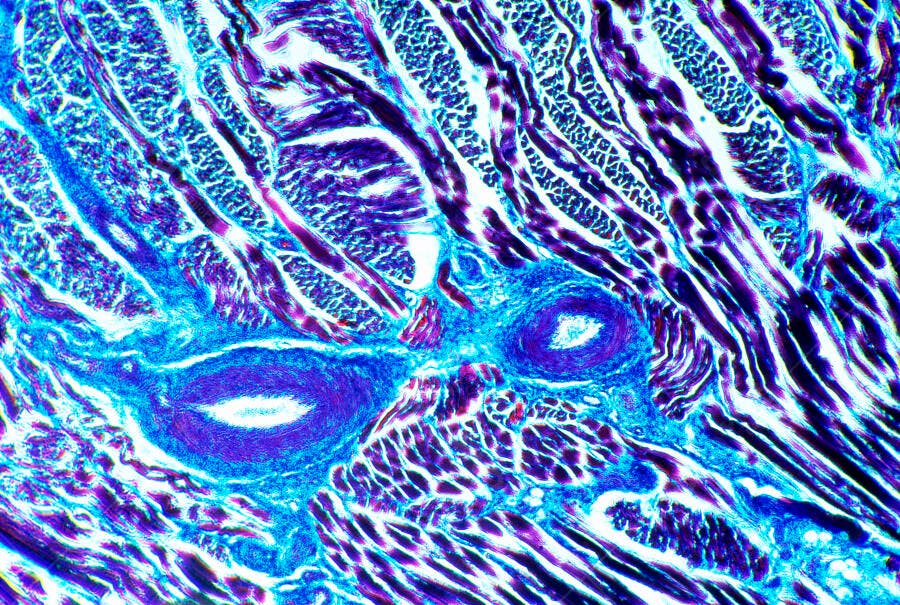 Microscopia Tecido Muscular Azul e Roxo