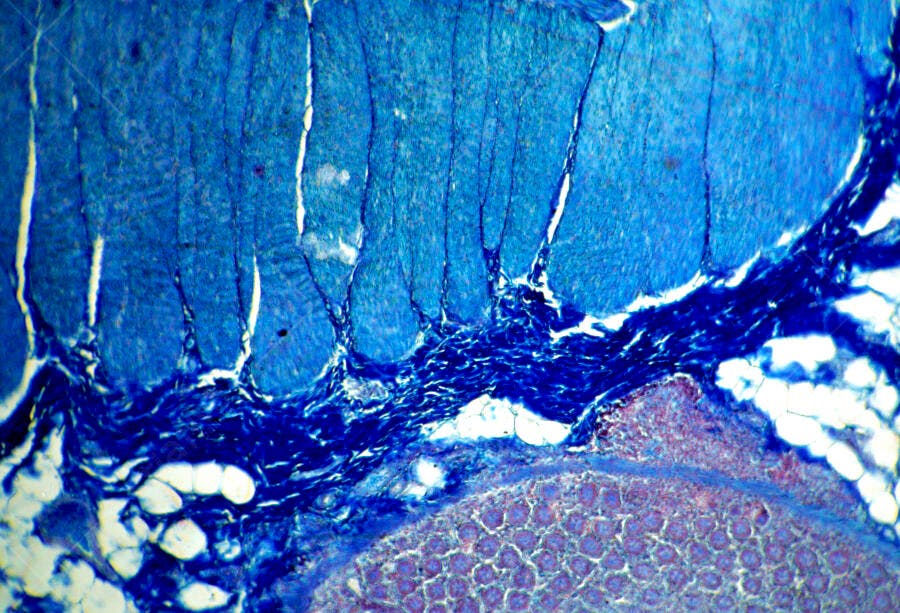 Microscopia Tecido Muscular Azul e Roxo