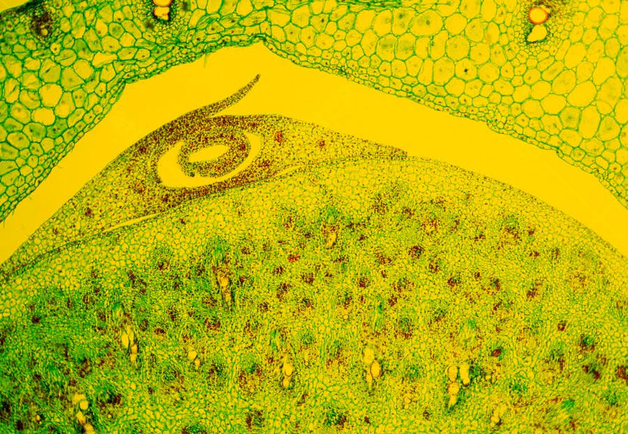 Microscopia vegetal células verdes e marrons