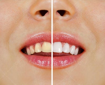 Saúde Dental (28)
