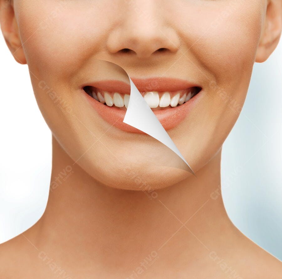 Sorriso branco e saudável após clareamento