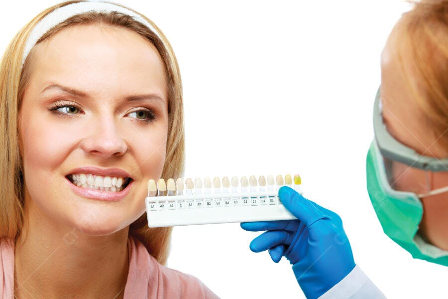 Clareamento dental mulher sorrindo