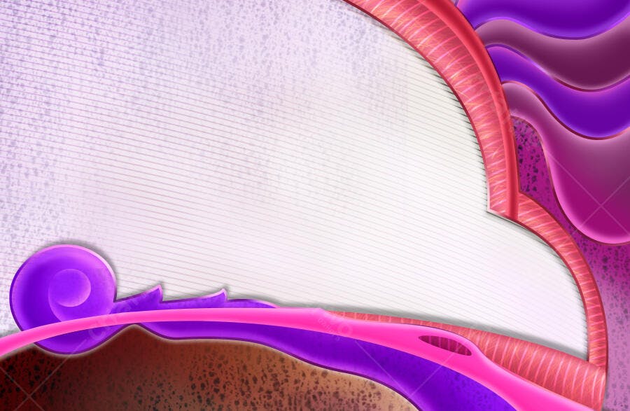 Arte Abstrata Rosa e Roxo com Linhas