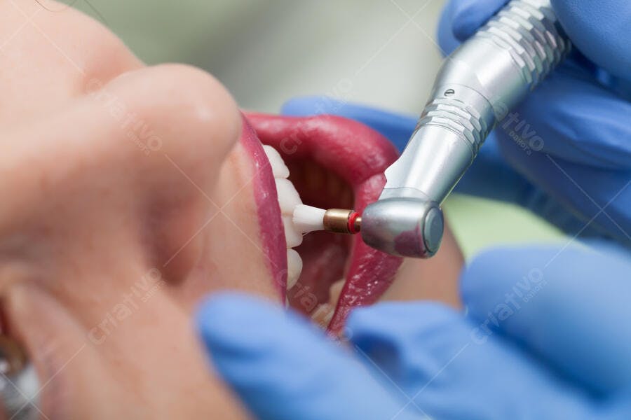 Limpeza dentária profissional com instrumento rotativo
