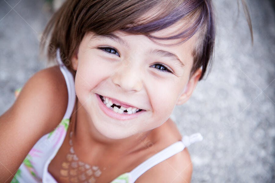 Menina sorrindo com dentes faltando