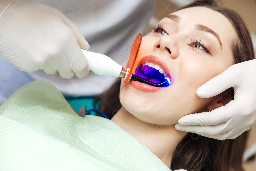 Clareamento dental luz azul profissional