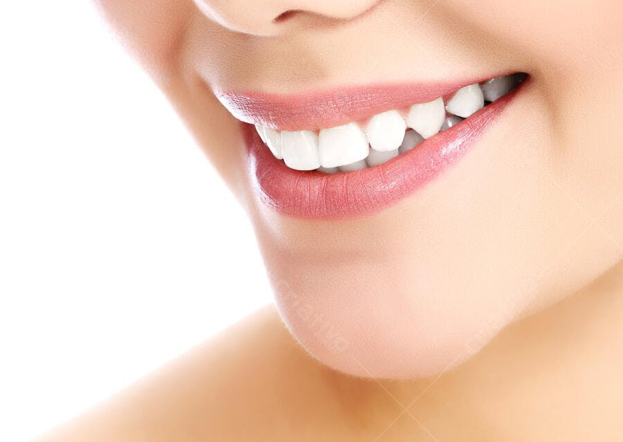 Sorriso brilhante dentes brancos pele saudável