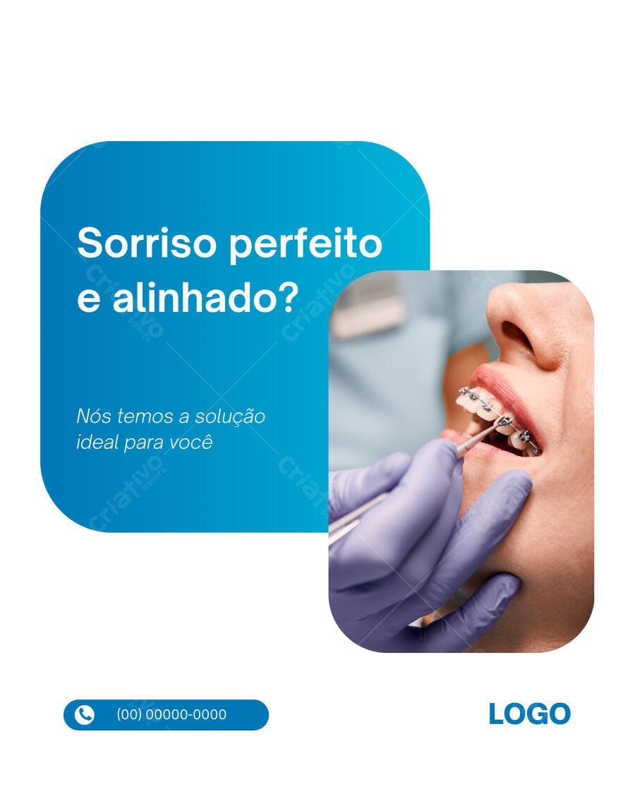 Post Instagram Odontologia Sorriso Perfeito Editável no Canva