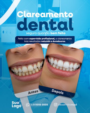 Clareamento Dental Social Media PSD Editável