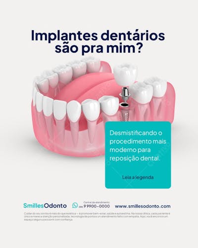 Flyer Odontológico Implantes Dentários PSD Editável