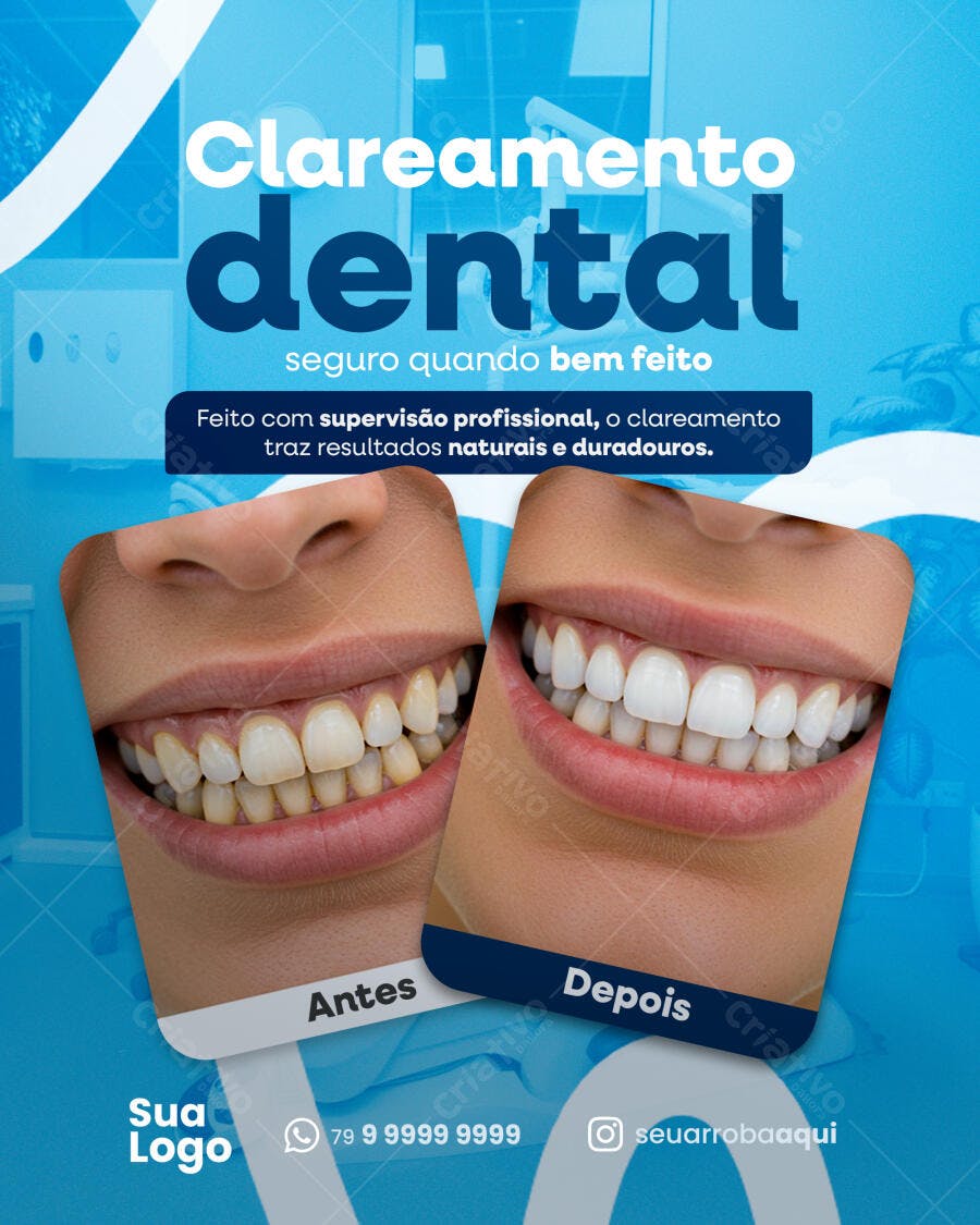Flyer Clareamento Dental PSD Editável