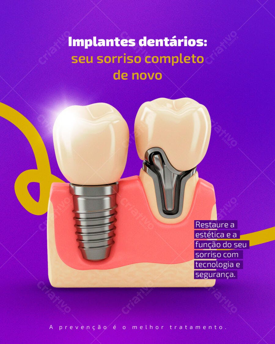 Flyer Implantes Dentários Seu Sorriso Completo de Novo PSD Editável