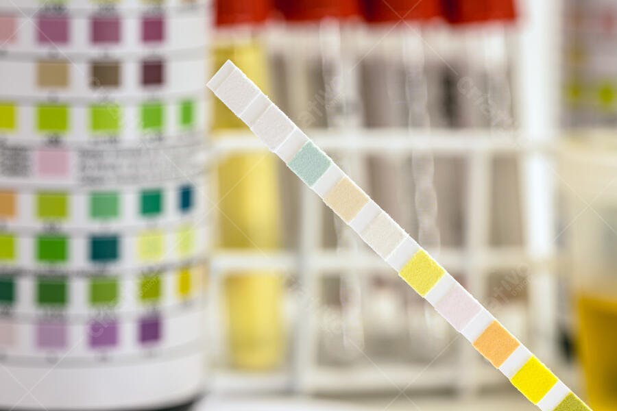 Fita reagente de teste de urina em laboratório médico com amostras