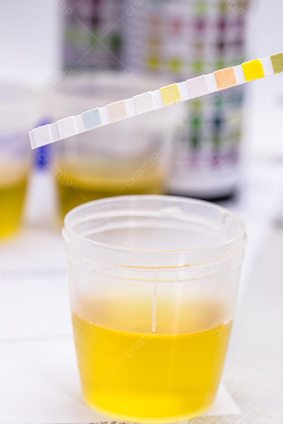 Tira reagente de exame de urina em laboratório médico com amostras amarelas
