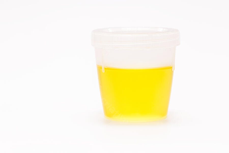 Amostra de urina amarela em copo de coleta para exame médico fundo branco