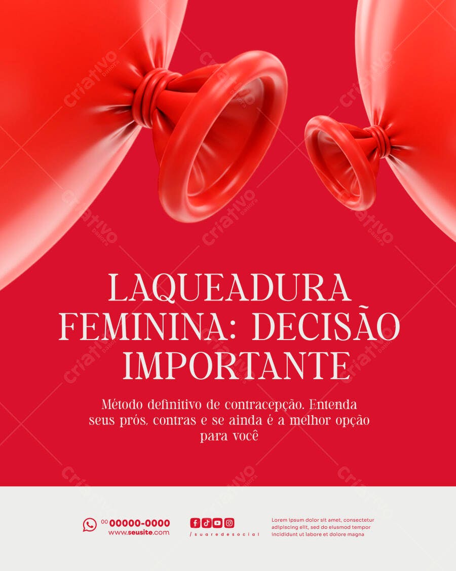 Flyer Laqueadura Feminina Contracepção Decisão Importante PSD Editável