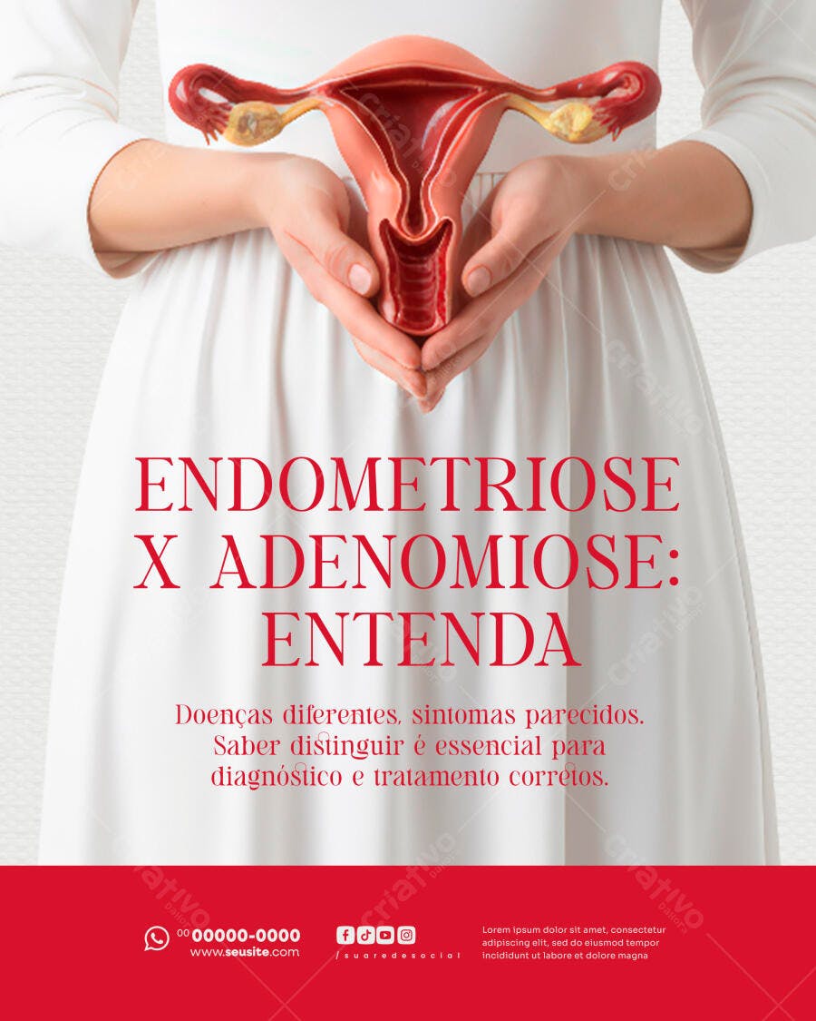 Post Redes Sociais Endometriose e Adenomiose Entenda PSD Editável