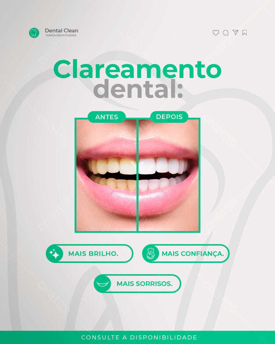 Flyer Clareamento Dental Antes e Depois PSD Editável
