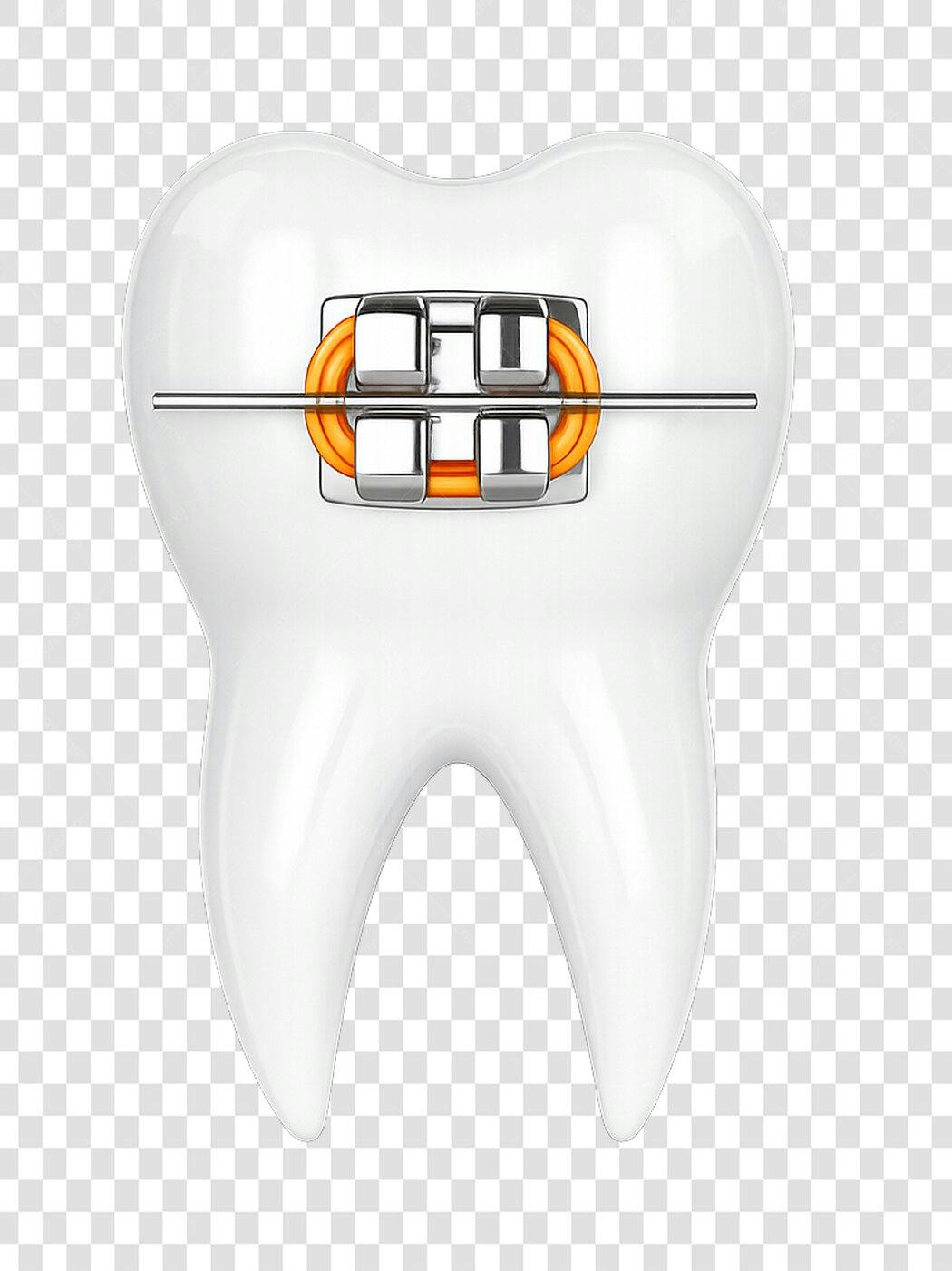 Elemento 3D Dente com Aparelho Ortodôntico PNG Fundo Transparente