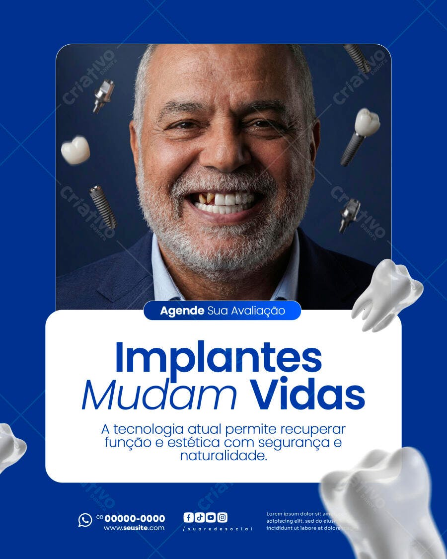 Post Instagram Implantes Dentários Odontologia PSD Editável