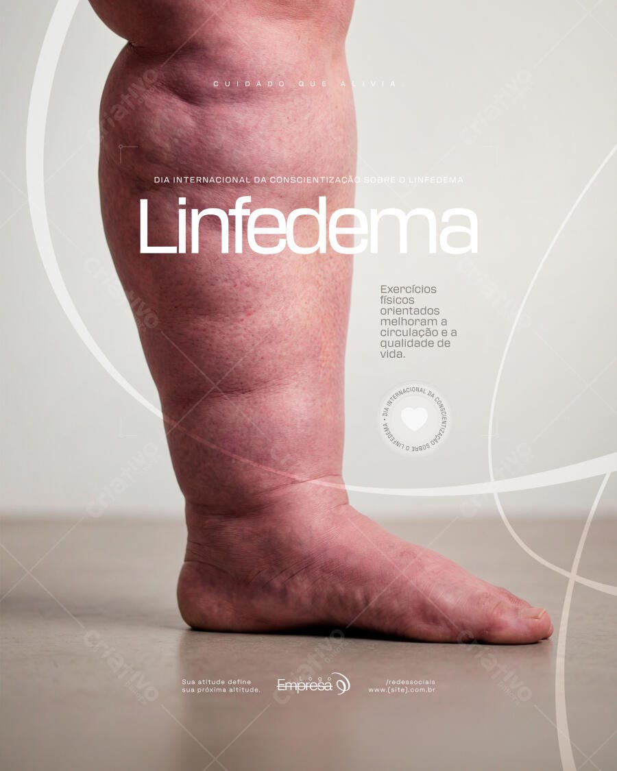 Post Linfedema Dia Internacional da Conscientização PSD Editável
