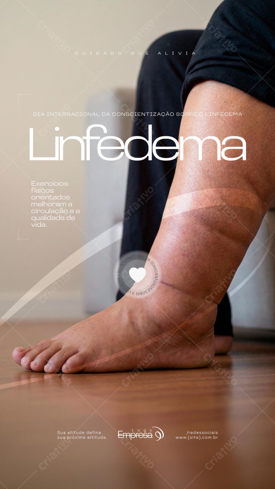 Story Instagram Conscientização Linfedema Saúde PSD Editável