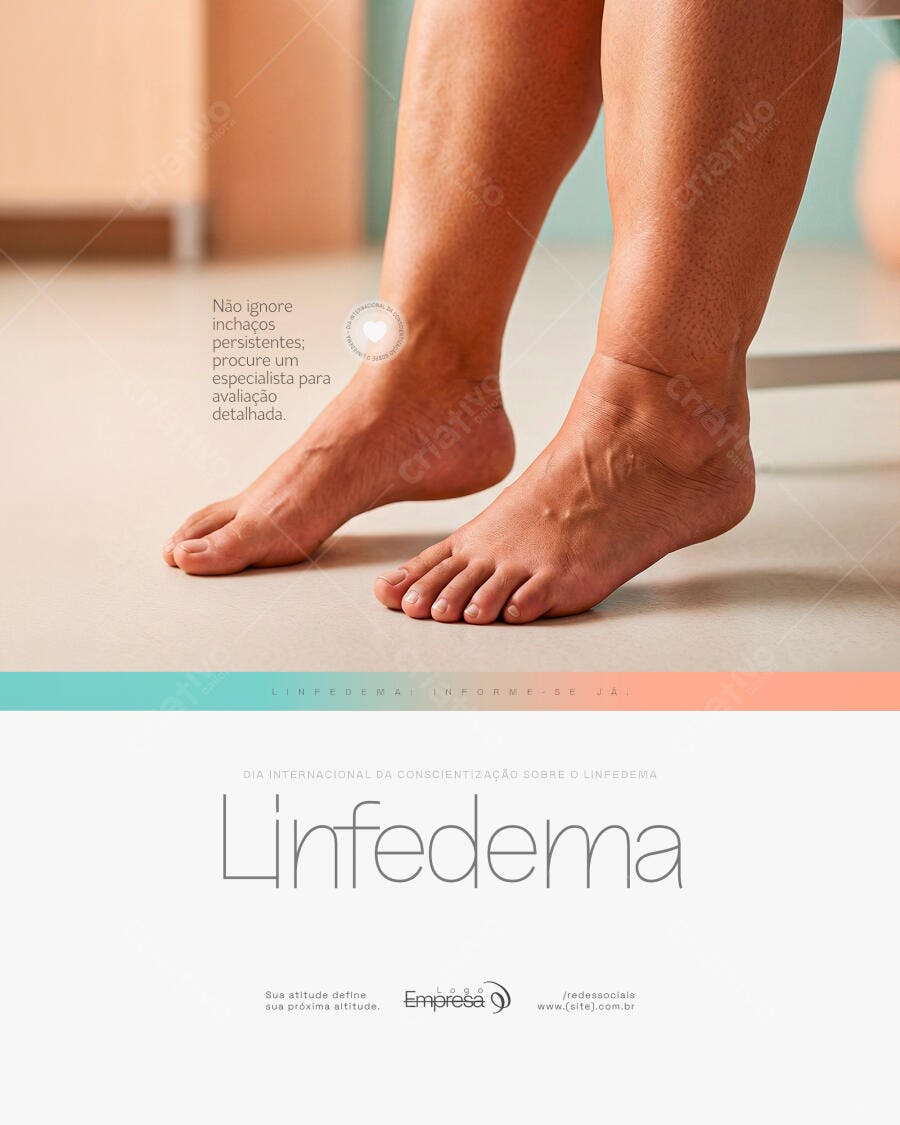 Flyer Linfedema Saúde Clínica Médica PSD Editável