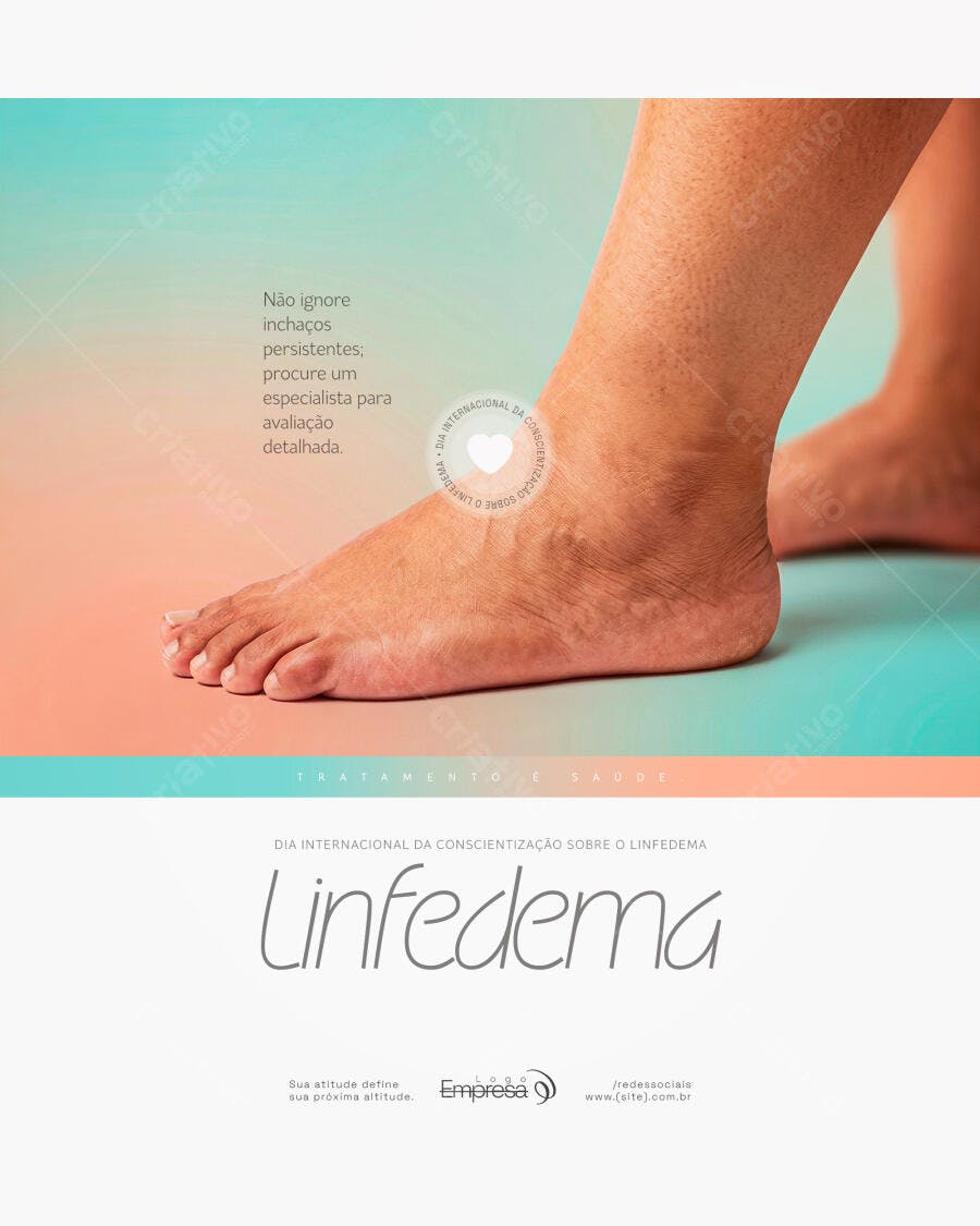 Post Linfedema Conscientização Saúde PSD Editável