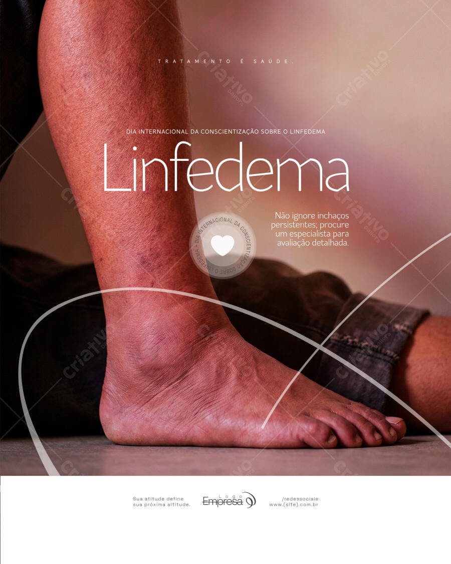 Flyer Linfedema Conscientização Saúde PSD Editável