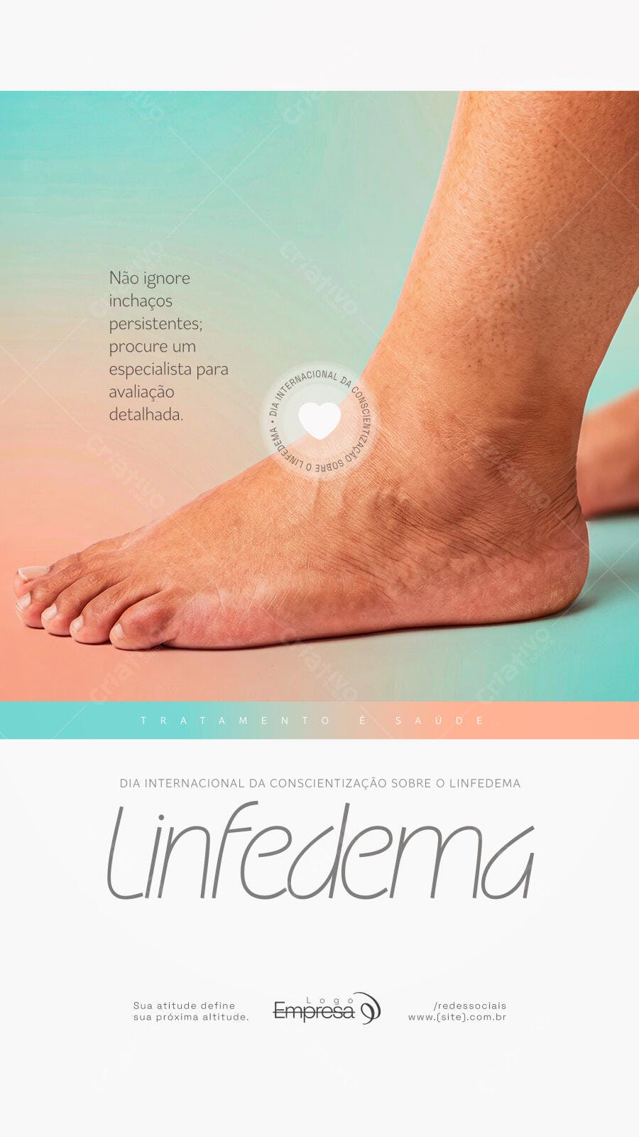 Post Línfedema Dia Conscientização Saúde PSD Editável