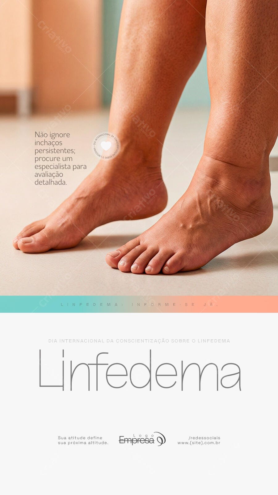 Post Instagram Conscientização Linfedema Saúde PSD Editável