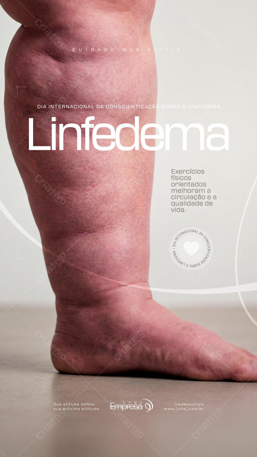 Post Instagram Dia Conscientização Linfedema Saúde PSD Editável