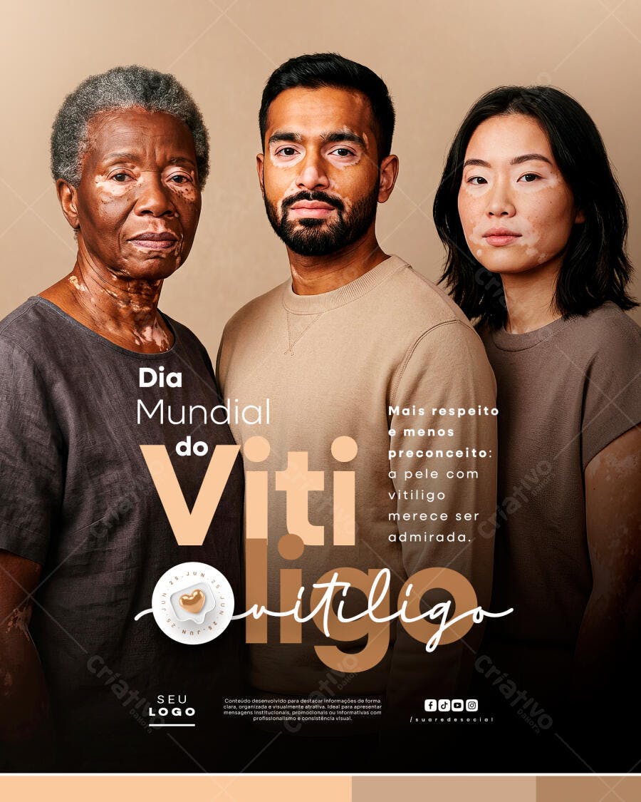Post Instagram Dia Mundial do Vitiligo PSD Editável