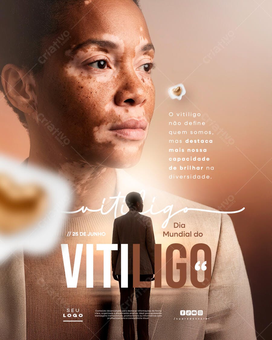 Post Instagram Dia Mundial do Vitiligo PSD Editável
