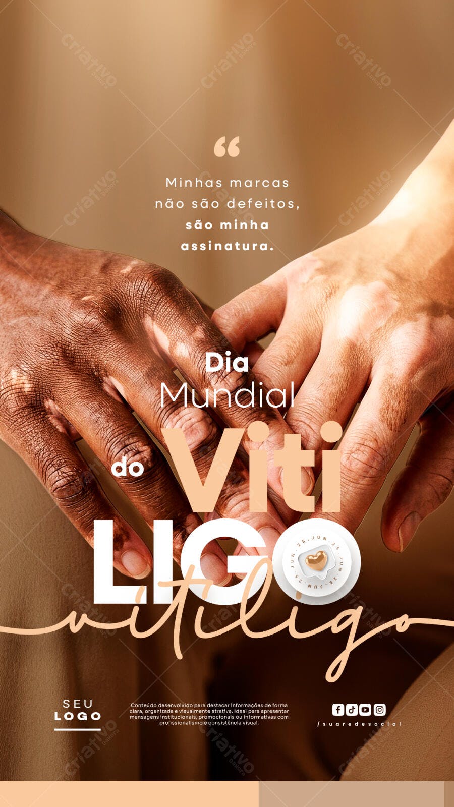 Story Dia Mundial do Vitiligo Conscientização PSD Editável