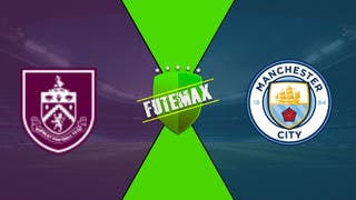 Burnley X Manchester City