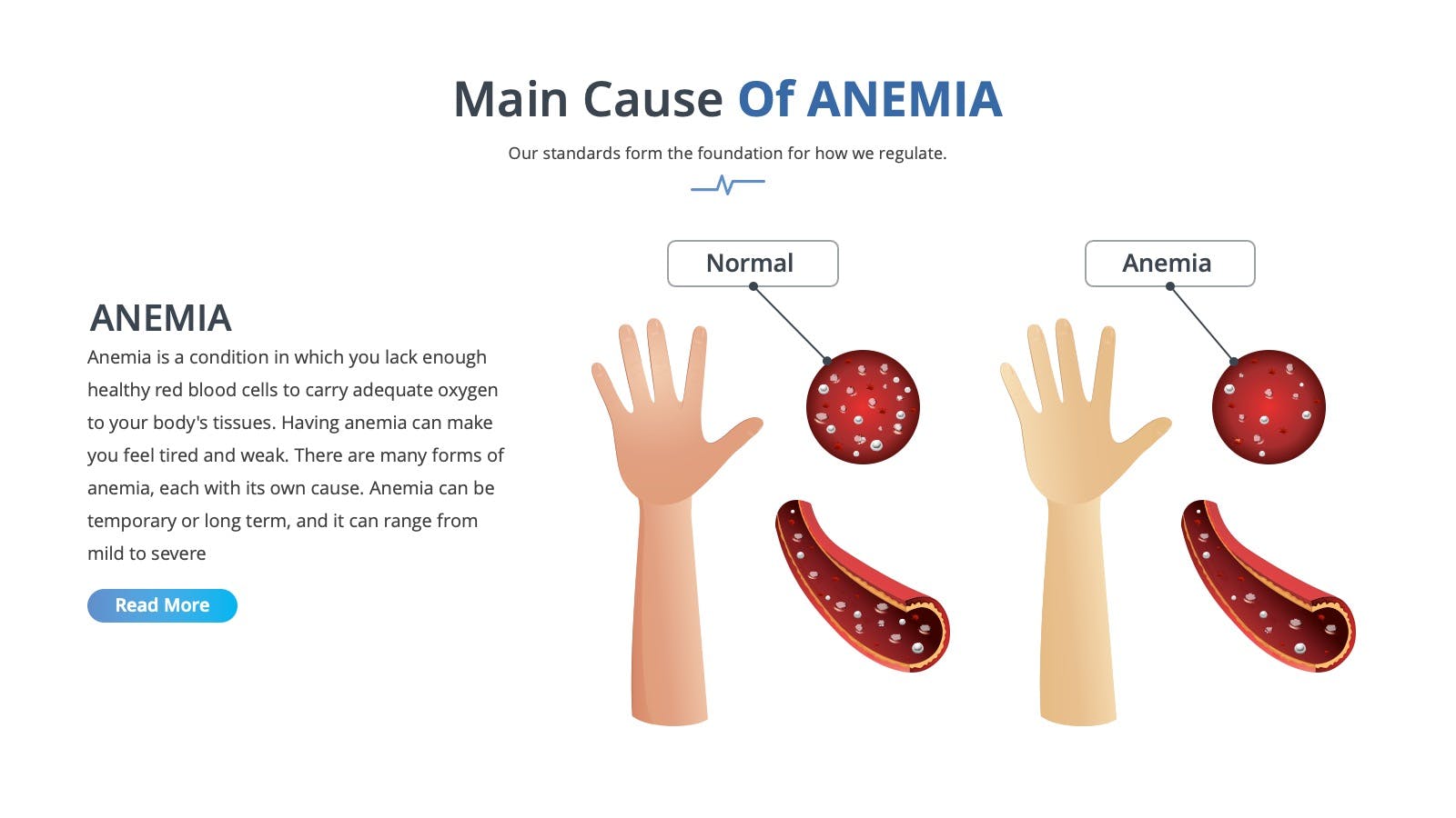Main cause of anemia Premast Plus Main cause of anemia Premast Plus